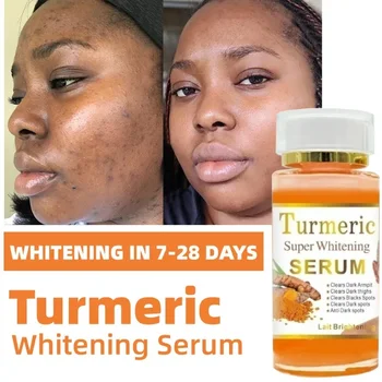  Turmeric Super Whitening е подходящ за черни петна по лицето и тялото, намаляване на пигментацията, стареещи петна, слънчеви петна от слънчево изгаряне